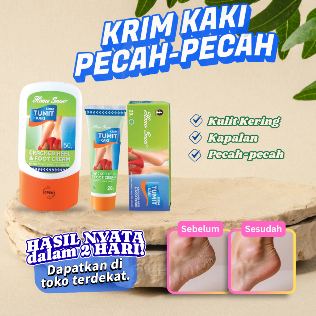 20g + 50g HOME SNOW KRIM TUMIT KAKI CRACKED HEEL & FOOT CREAM Krim Kaki Pecah Retak dan Kering Hasil