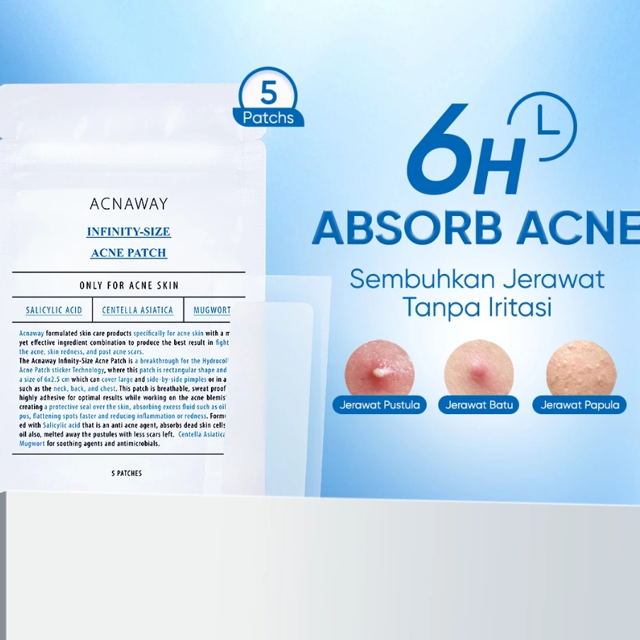 ACNAWAY Infinity Acne Patch (BIRU)