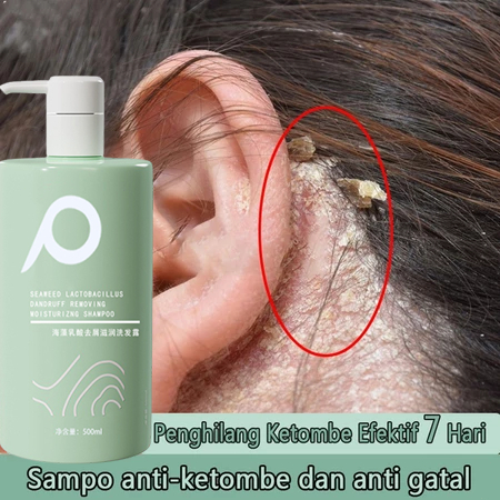 Sampo anti-ketombe dan gatal Sampo anti-ketombe Sampo anti-ketombe dan anti-rontok sampo anti ketomb