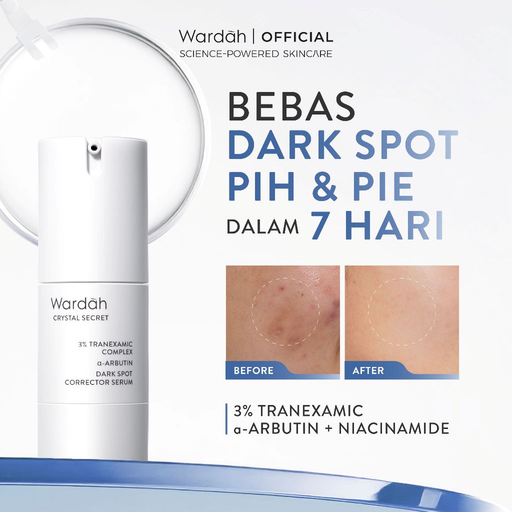 WARDAH CRYSTAL SECRET SERUM NIACINAMIDE Tranexamic Acid TXA + Alpha Arbutin Dark Spot Brightening Se