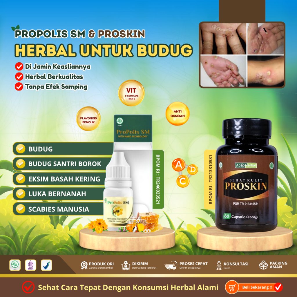 Obat Budug Borok, Obat Budug santri, Obat Gudig / Gudik, Obat Scabies manusia, Obat Kurap kudis eksi