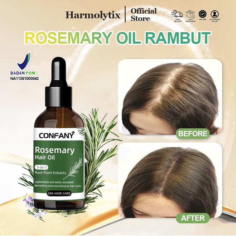 Rosemary Oil Rambut Hair Serum Penumbuh Rambut Cepat Dan Tebal Minyak Penumbuh Rambut Cepat Penebal 