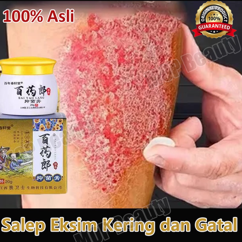 Salep gatal salep eksim kering dan gatal salep china gatal paling ampuh eksim kering salep gatal sel