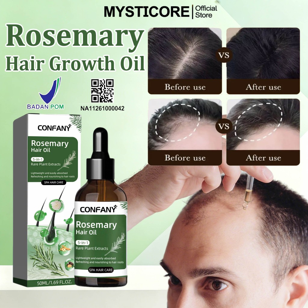 Hair Serum Penumbuh Rambut Rosemary oil rambut Serum rambut rontok obat penumbuh rambut Serum Penumb