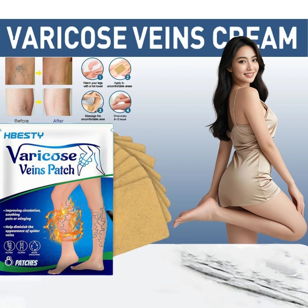 Koyo Varises Penghilang Varises Di Kaki Varicose Patch Obat Varises Herbal Koyo Varicose 8pcs