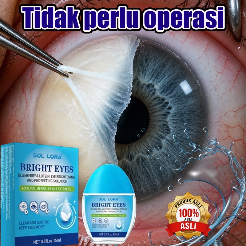 0bat Tetes Mata Katarak tetes mata minus paling ampuh Mata kering Sakit mata Darah Merah Ketegangan 