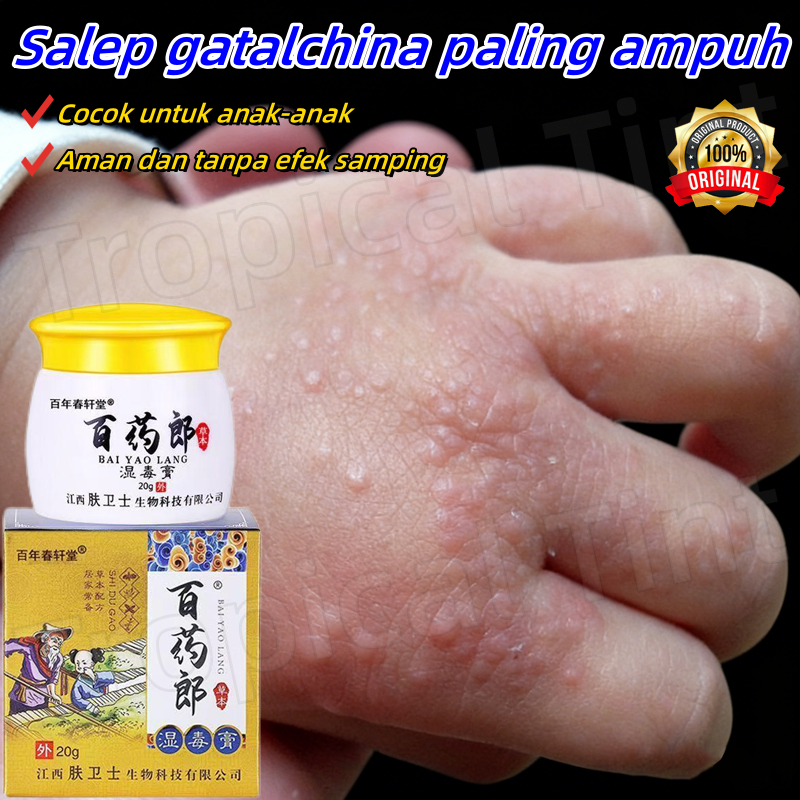 Salep gatal china paling ampuh salep gatal jamur selangkanga Krim Eksim Bayi dan Anak Obat gatal sel