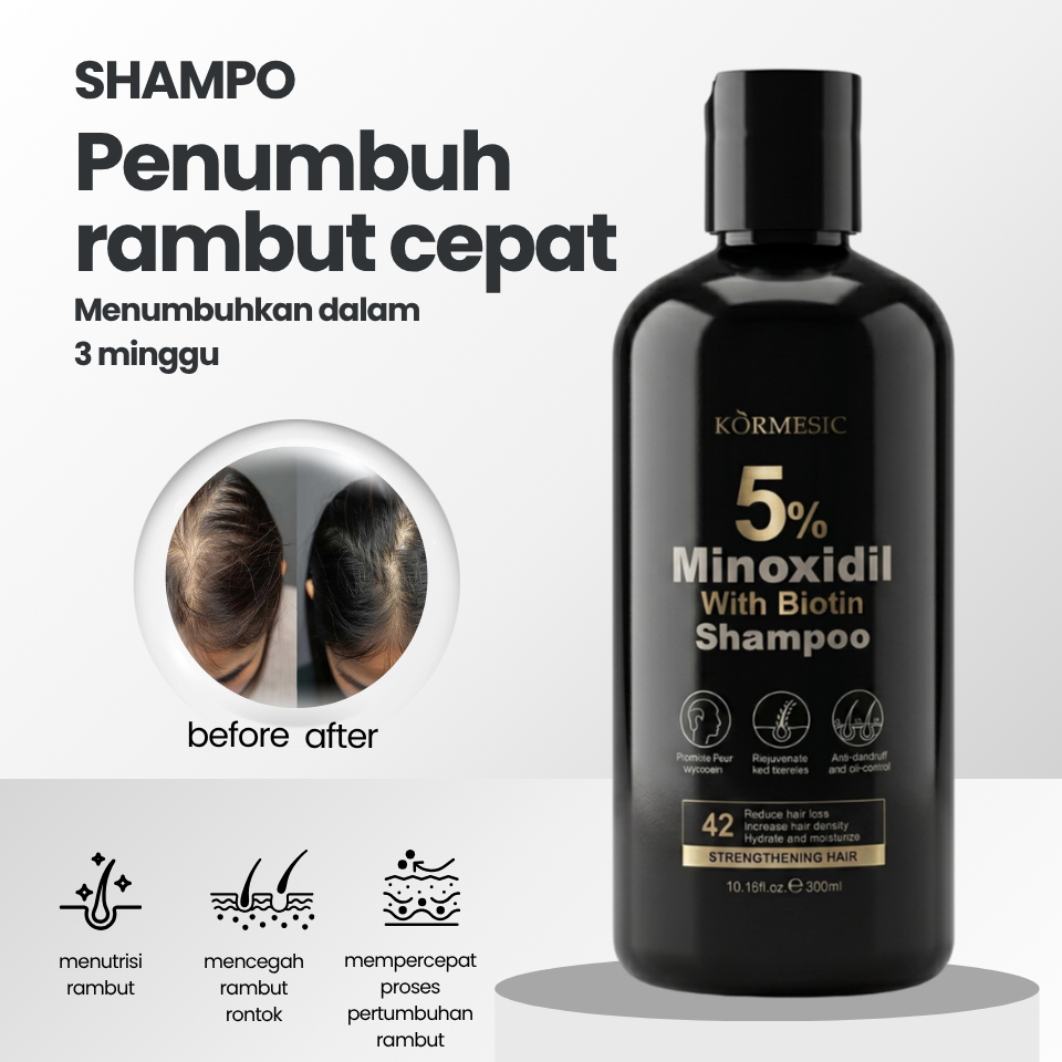 (COD) Shampo Hair Fall Penumbuh Rambut Cepat Asli Original 300ml Minoxidil 5% - Penumbuh Penebal Pem