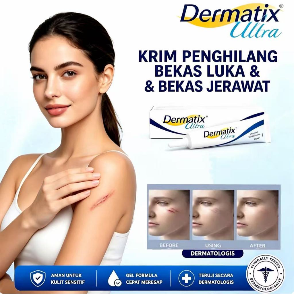 [ORI & Beli 2 gratis 1] Dermatix Ultra Scar Gel 15Gr Cream Krim Penghilang Bekas Luka 15 Gram Strech