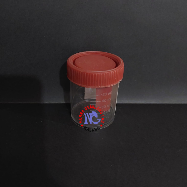 Faeces Container 50-60 ml | Pot Feses Non Steril