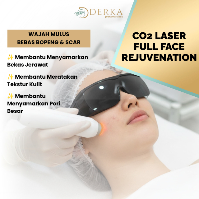 Derka Skin CO2 Laser Full Face Bekas Jerawat Scar Treatment Voucher