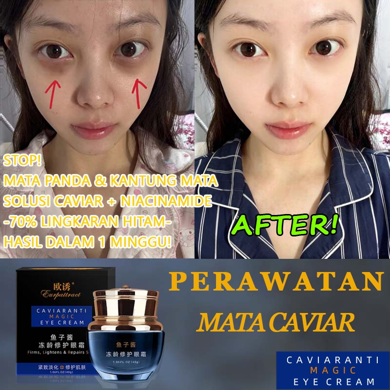Krim Mata,krim mata panda dan kantung mata,40g,krim mata caviar niacinamide,Mengencangkan Area Sekit