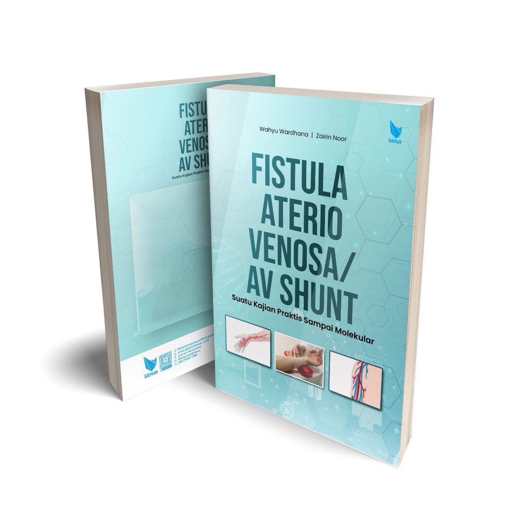 FISTULA ARTERIO VENOSA/AV SHUNT Suatu Kajian Praktis Sampai Molekular - PKT