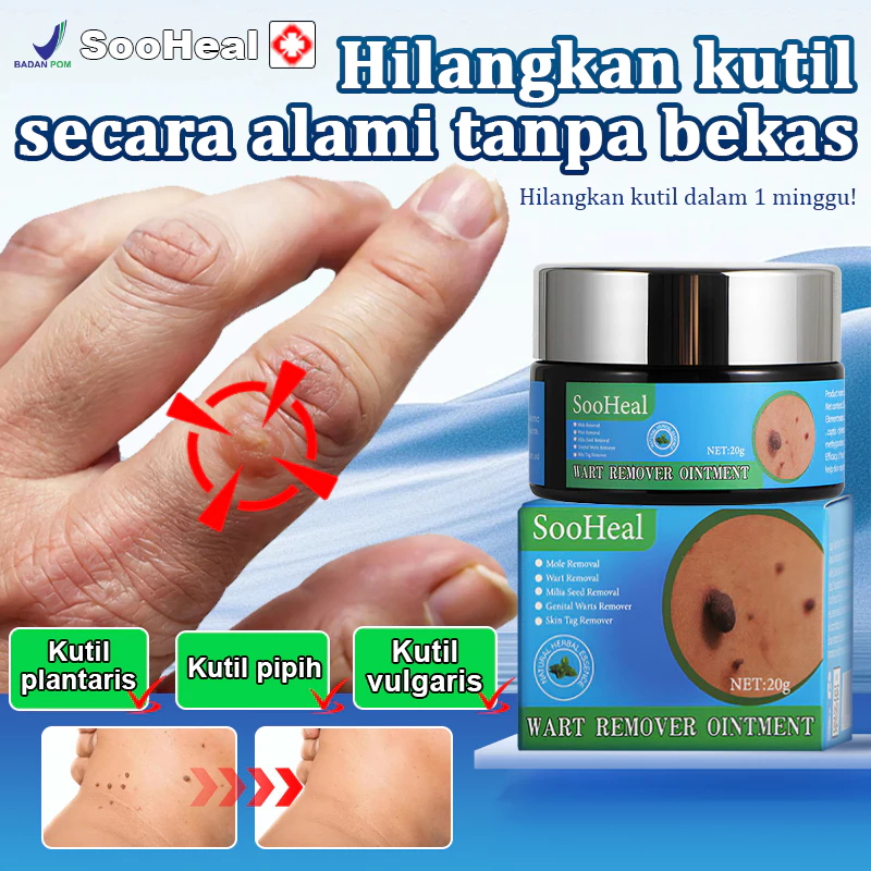 Salep kutil paling ampuh callusol kutil Aman tanpa efek samping Menghilangkan kapalan, kutil, mata i