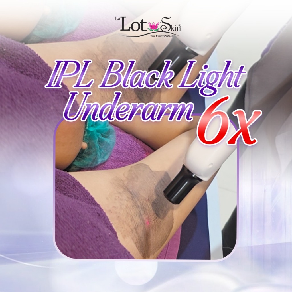 IPL Black Light Underarm 6x