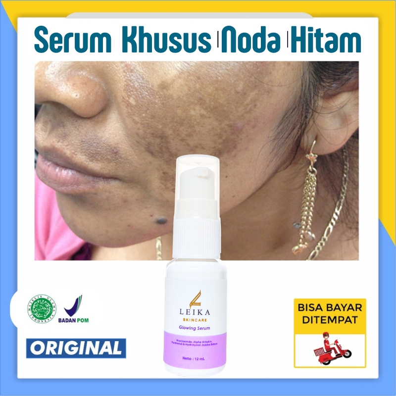 AMPUH Serum Penghilang Flek Hitam Membandel Menahun obat flek hitam Perawatan Wajah Flek Serum Serum