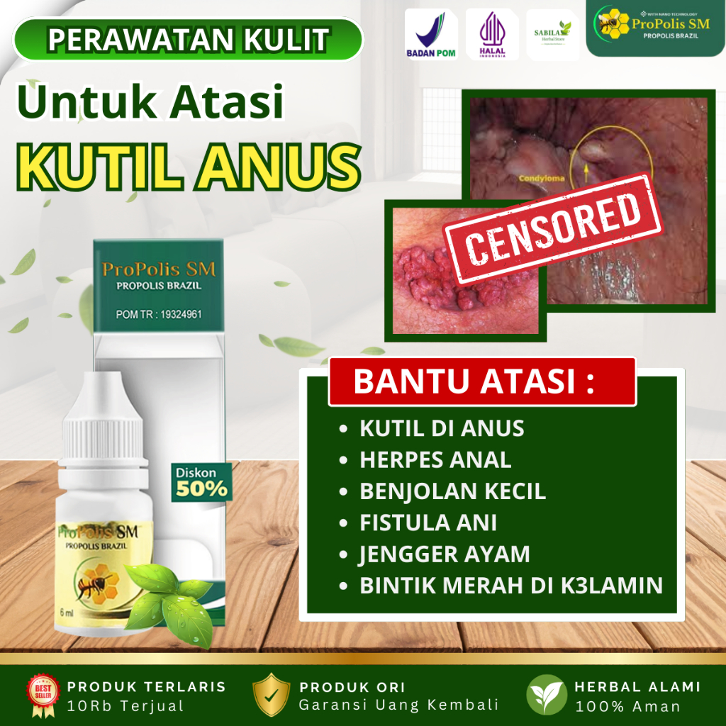 Obat Perontok Kutil Di Anus Benjolan Kecil Kutil Dubur Daging Jadi Kutu Jamur Di Anus Herpes Anal De