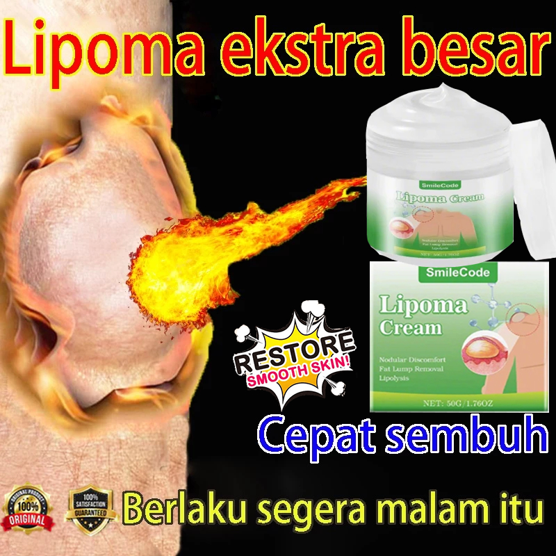 [100%efektif] Obat Benjolan Lipoma Obat herbal Cina Krim lipoma 50g Perawatan punggung/leher/paha Ka