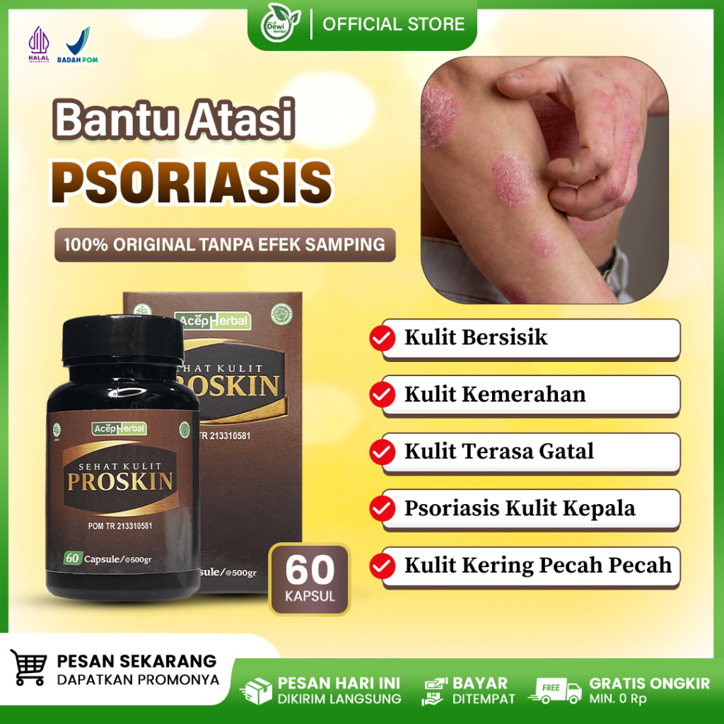 Obat Psoriasis Kulit Kering Bersisik Kemerahan Terasa Gatal Dan Terbakar Kulit Pecah Pecah Di Siku, 