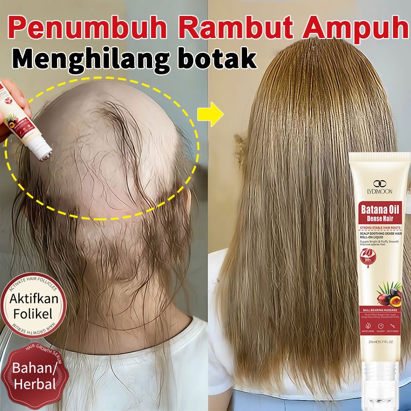 Serum Penumbuh Rambut Hair growth Serum Roller 20ml penumbuh anti rambut botak Penumbuh rambut cepat