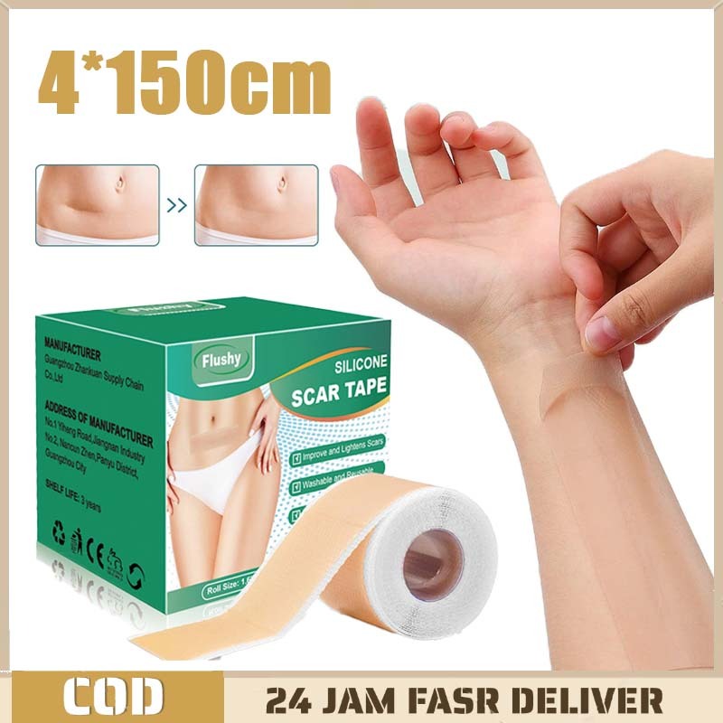 4cm X 150cm Scar Sheet Silicone Scar Sheet Keloid Madjur Silicone Scar Sheet Scar Sheets