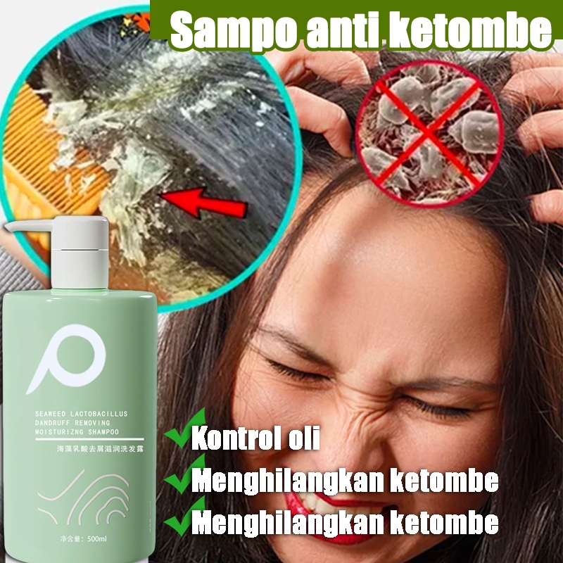 Expert Dandruff Relief Shampoo 500 ml Perawatan Kulit Kepala Gatal Ketombe Berkerak Sensitif Eksim P