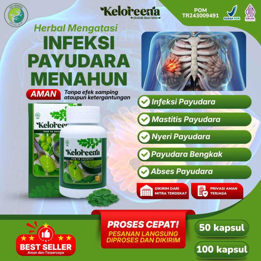 Obat Infeksi Payudara, Mastitis Payudara, Nyeri Payudara, Payudara Bengkak Menyusui, Abses Payudara