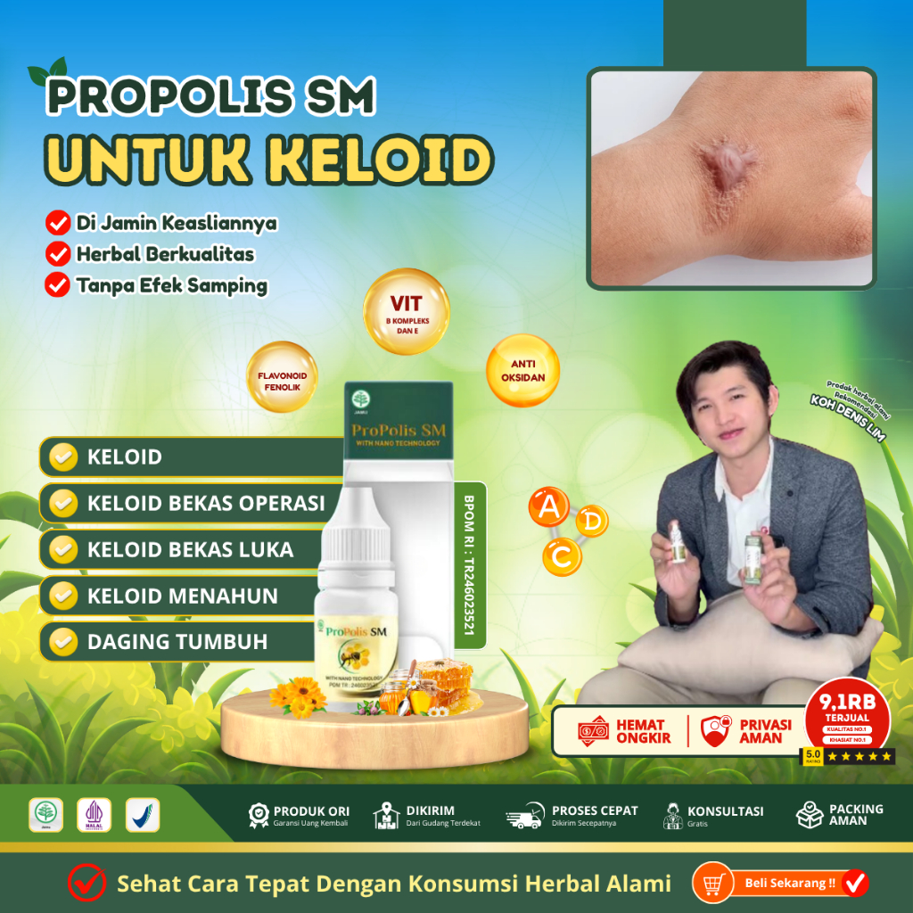 Penghilang Keloid / Daging Tumbuh  / Skin tag di Telinga - Pengempis Keloid Menahun - Obat Keloid
