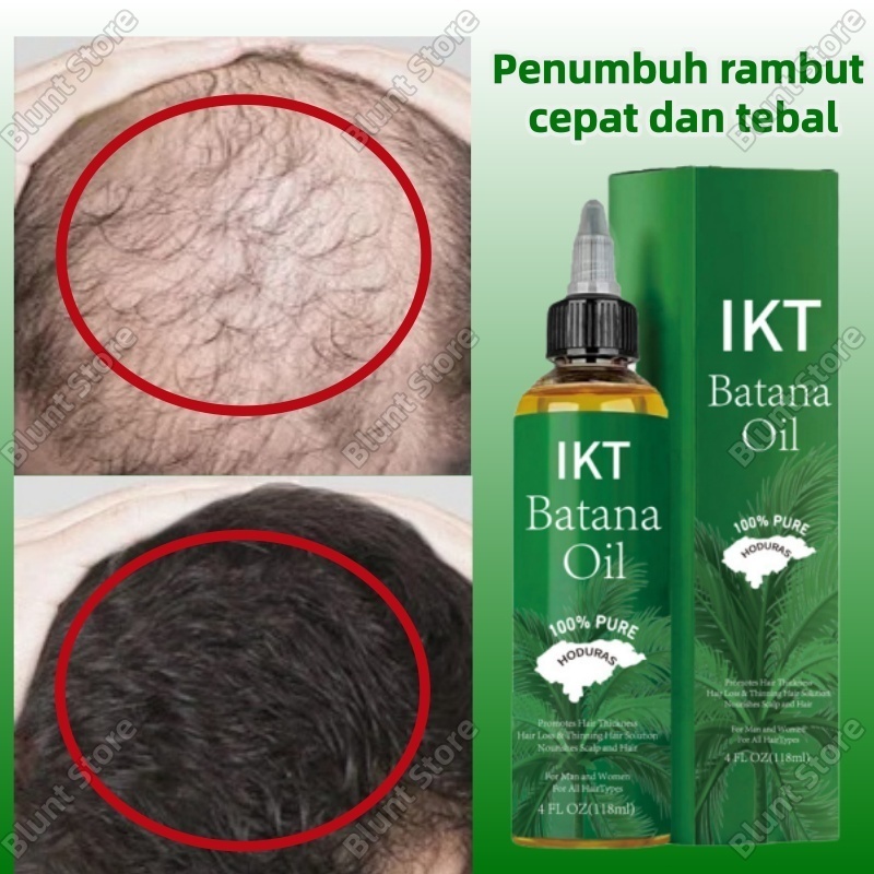 Hair Serum Penumbuh Rambut Cepat Dan Tebal Hair Tonic Rambut Rontok Penghitam Rambut Uban Permanen