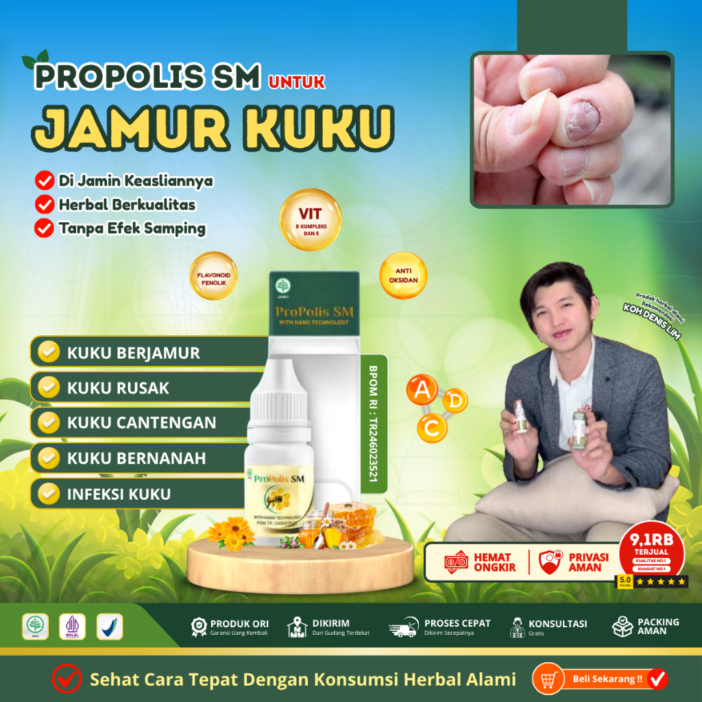 Obat Kuku Jamur dan Rusak , Obat Jamur Kaki, Obat Kuku Busuk, Obat Kuku Hitam Jamuran Rusak, Obat te