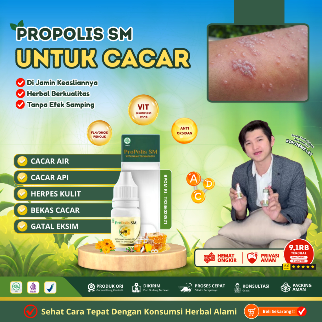 Obat Cacar dan Bekas Cacar , Obat Campak Anak / Dewasa, Obat Cacar Air, Cacar Api, Cacar Ular, Cacar
