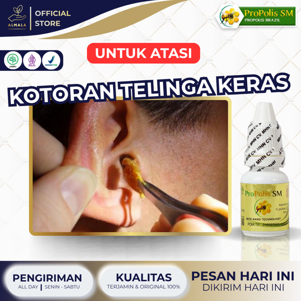 Obat Tetes Kotoran Telinga Keras, Obat Penghancur Kotoran Telinga Keras, Obat Pelunak Kotoran Teling