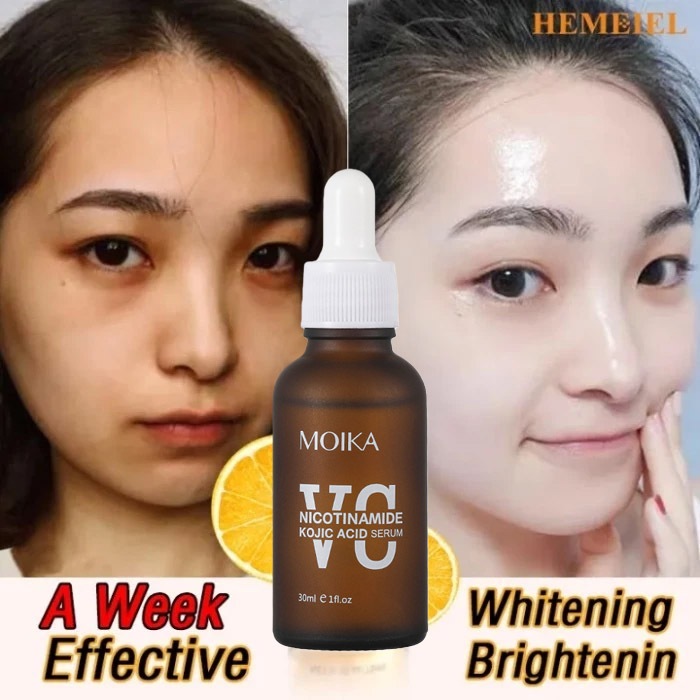Serum Vitamin C Dan Niacinamide - Mencerahkan & Pudarkan Bintik Hitam
