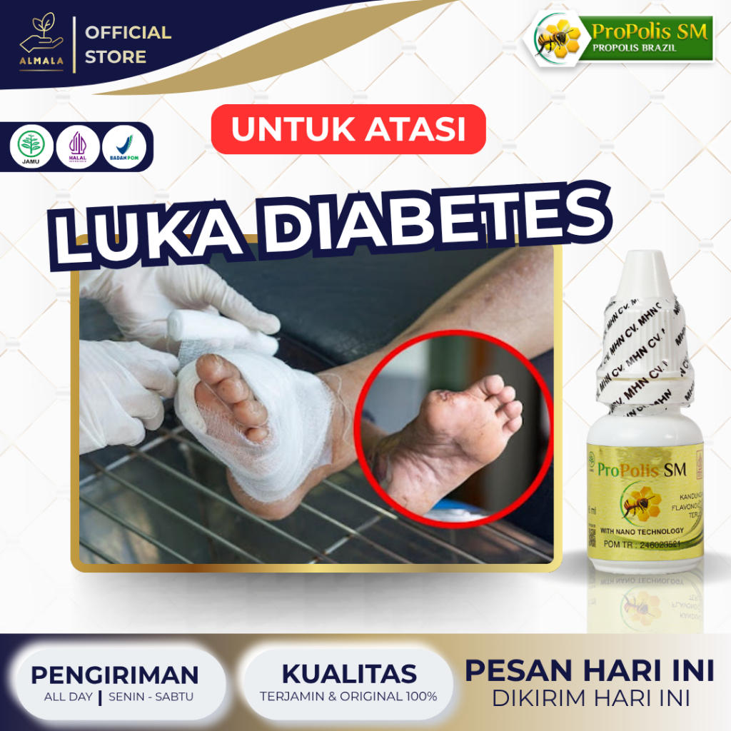 Obat Luka Diabetes Obat Pengering Luka Diabetes Obat Luka Diabetes Kering Obat Luka Diabetes Basah L