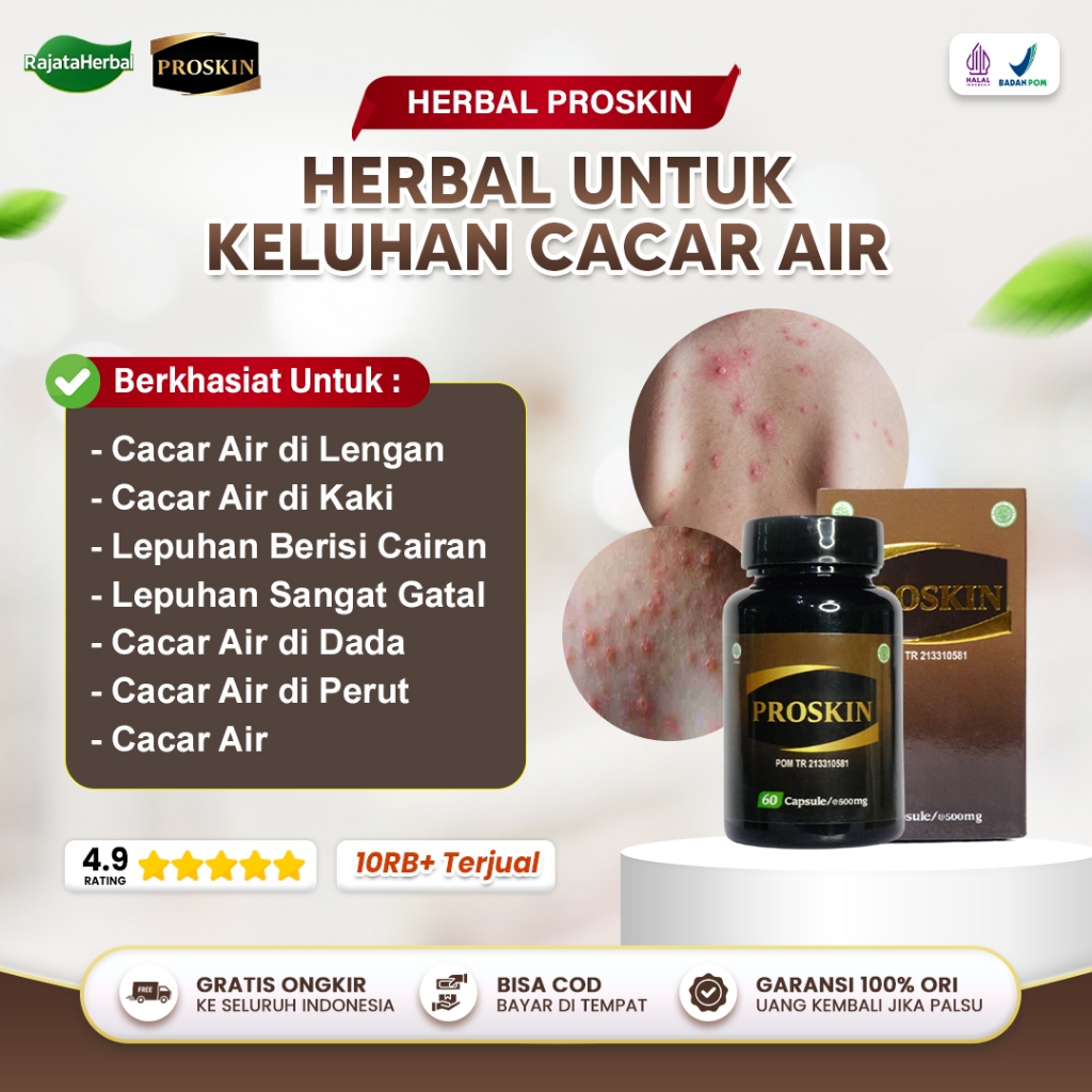 Obat Cacar Air Di Punggung Dada Cacar Air Di Lengan Kaki Gatal Kuat Bintik Merah Kecil Sehat Kulit P