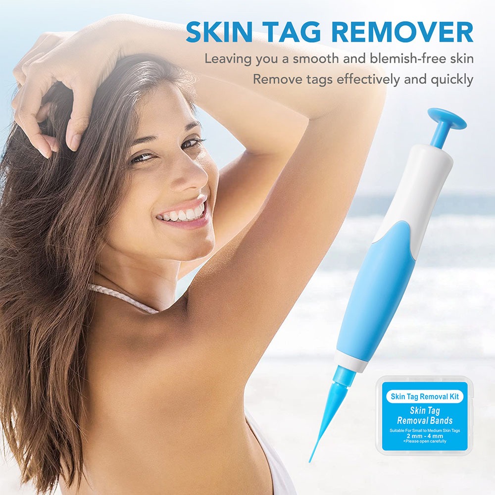 Alat Penghilang Kutil Auto Skin TagMole Removal Kit Tanpa Rasa Sakit High Quality LGV41 Blue