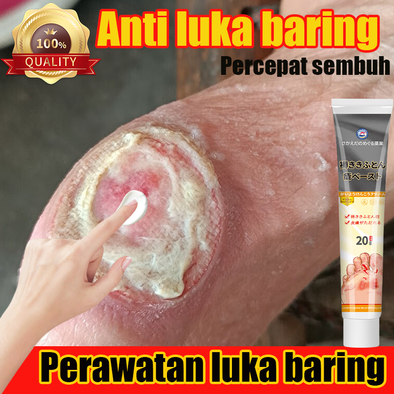 salep dekubitus,salep luka basah,krim luka baring,Salep dekubitus untuk lansia,dekubitus Luka diabet