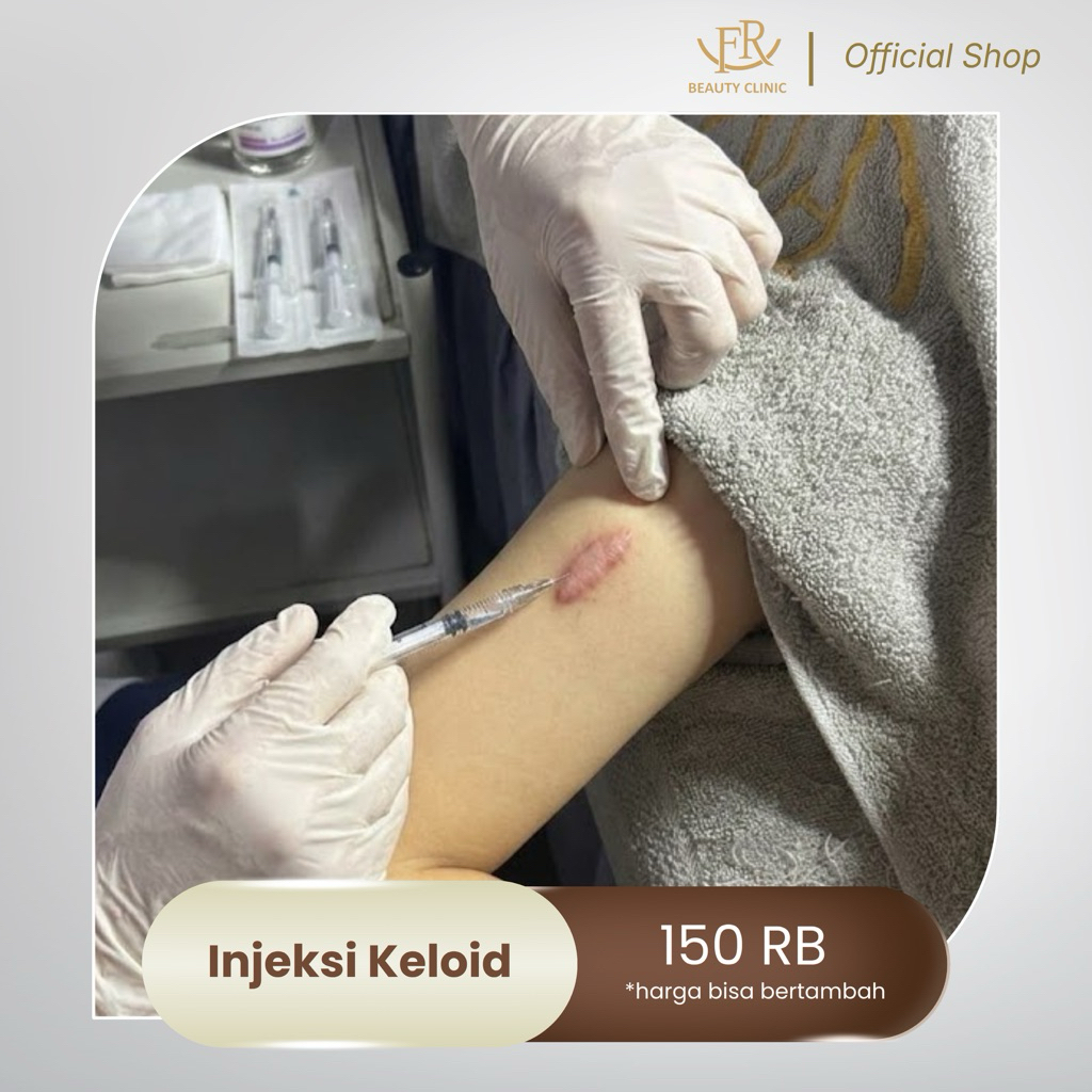 FR Beauty Clinic Injeksi Keloid