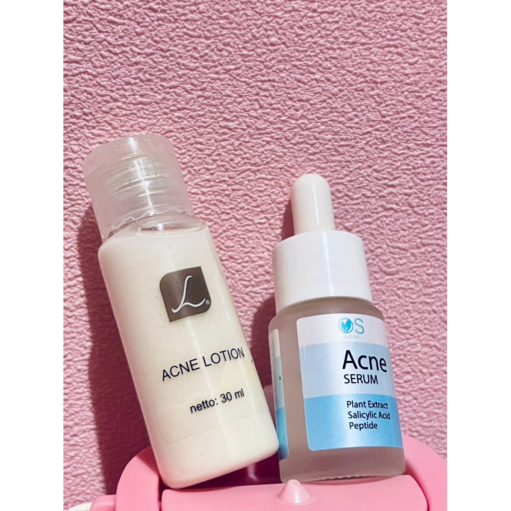 SERUM ACNE LARISSA | ACNE LOTION LARISSA