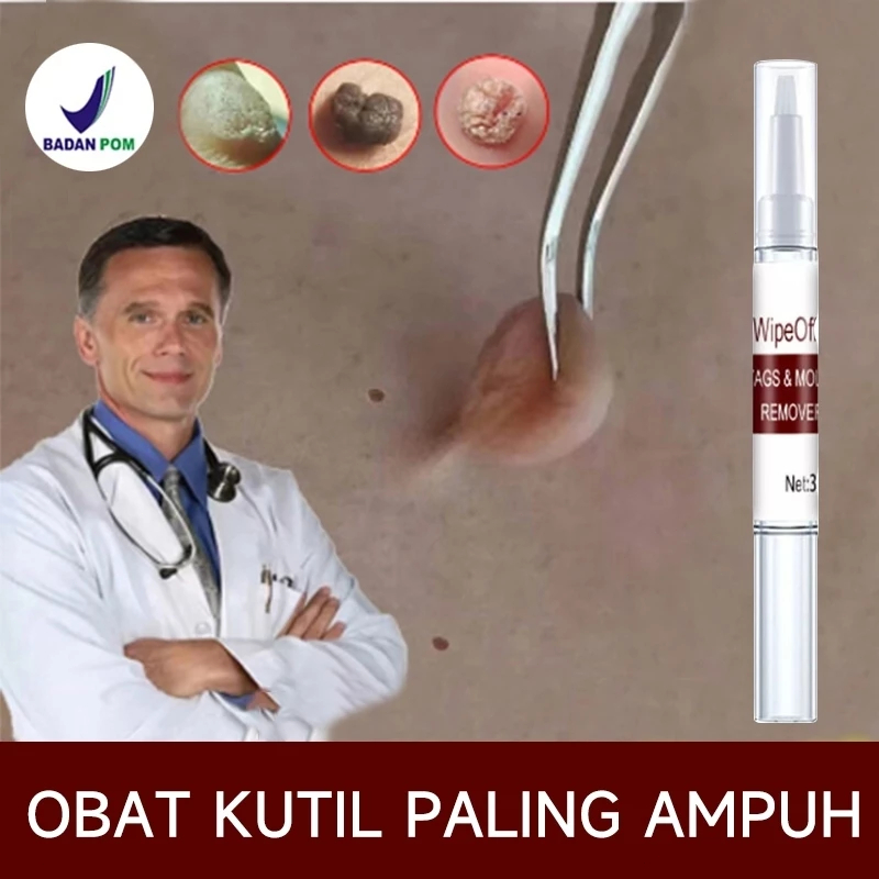 Obat penghilang tahi lalat obat penghilang kutil obat kutil paling ampuh 100%Original obat kutil kel