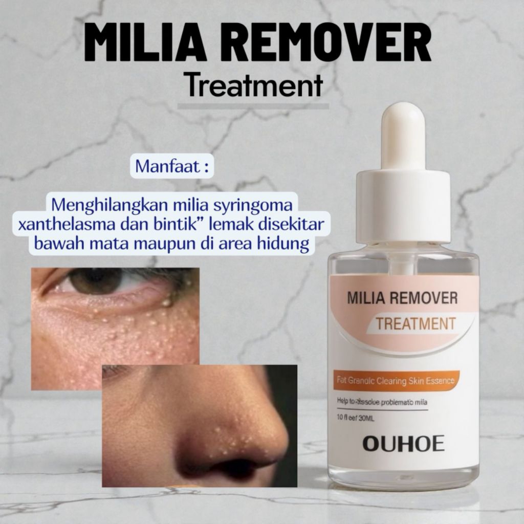 Milia remover serum penghilang perontok milia bintik putih mata Ouhoe Milia Remover Treatment Oil-Fr
