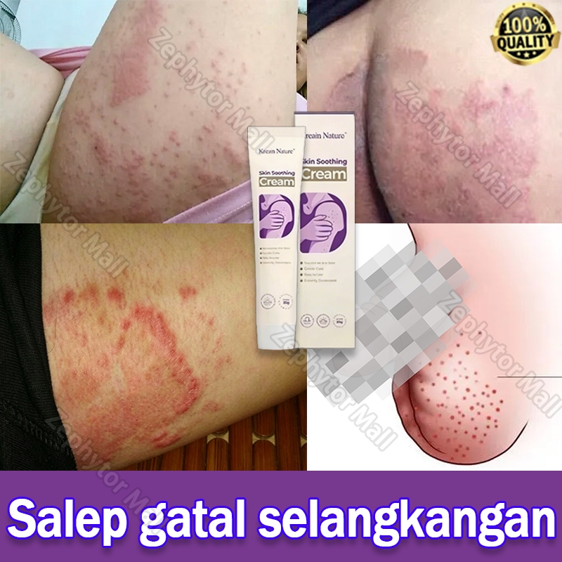 Salep Gatal Selangkangan Salep Eksim Kering Dan Gatal Obat Gatal Kulit Psoriasis Cream Skin Soothing