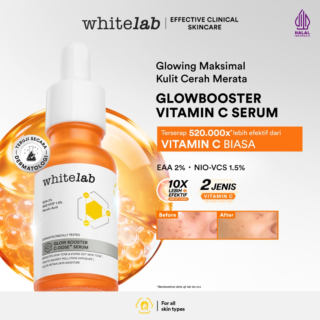 Whitelab Serum Vitamin C Glow Booster - Antioksidan Tinggi untuk Kulit Cerah dan Glowing C-Dose+ den