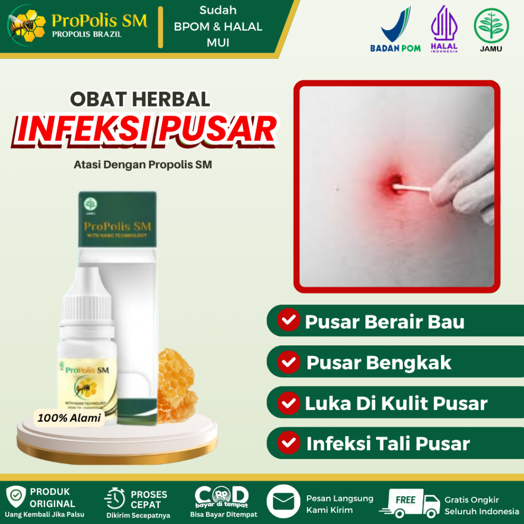 Obat Infeksi Pusar Bernanah, Pusar Berair Bau Busuk, Pusar Bengkak, Infeksi Tali Pusar, Daging Tumbu
