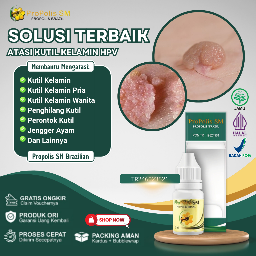 Obat Kutil Kelamin HPV Kutil Anus Perontok Penghilang Kutil Kelamin Pria Wanita Dengan Propolis SM