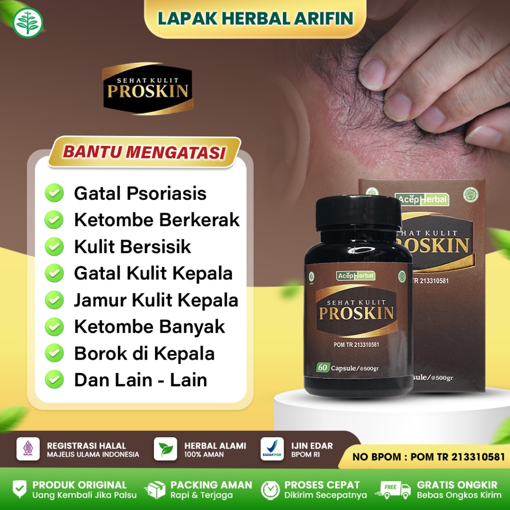 Obat Psoriasis Kulit Kepala - Obat Ketombe Berkerak - Proskin Kapsul