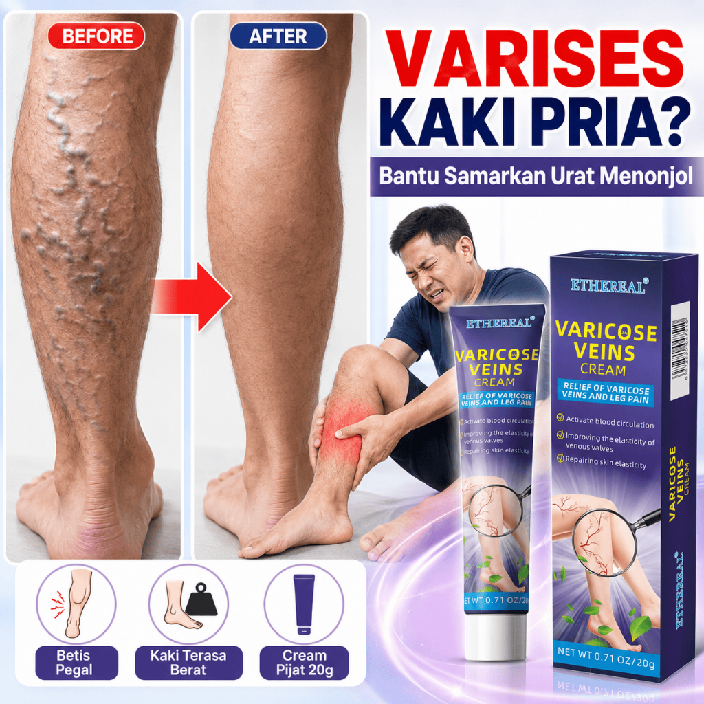 Krim Varises Kaki Pria 20g Obat Varises Salep Varises Varicose Veins Cream Untuk Urat Menonjol Betis
