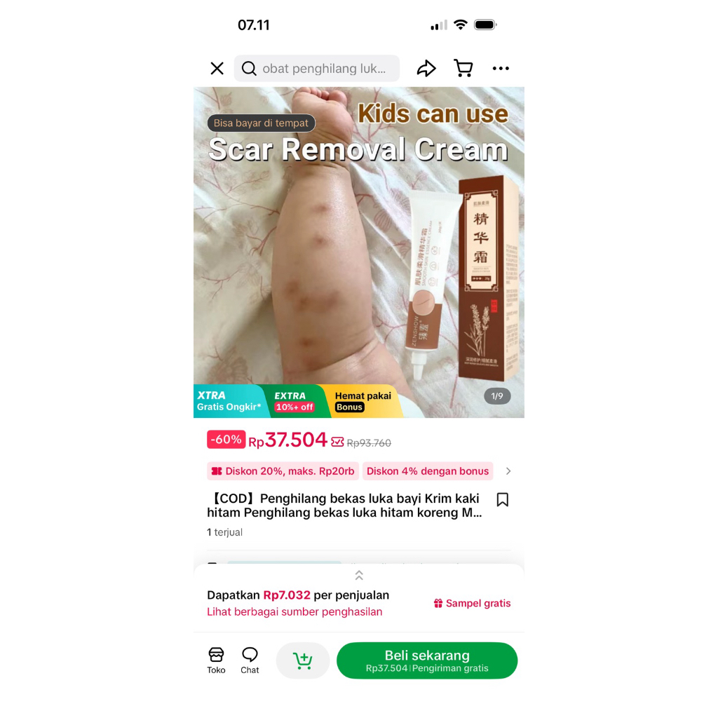 Penghilang bekas luka bayi Krim kaki hitam Penghilang bekas luka hitam