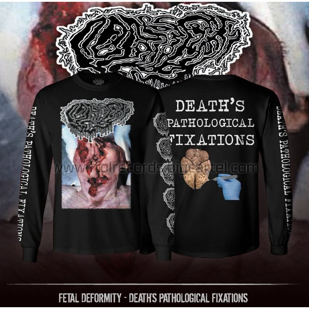 LS - FETAL DEFORMITY - Death’s Pathological Fixations