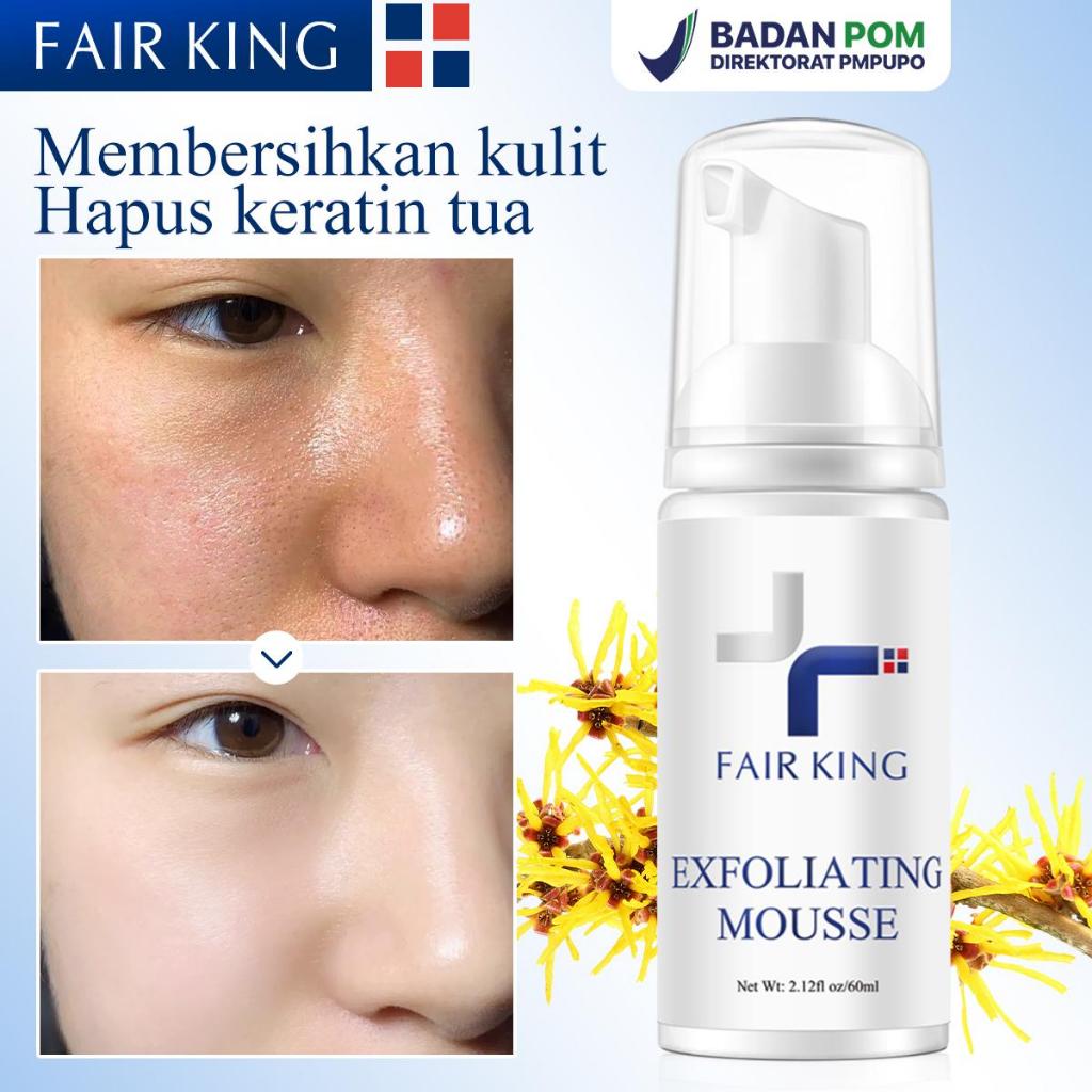 FAIR KING [BPOM] Facial Exfoliating Mousse Peeling Gel Face Scrub Deep Remove Cleaning All Skin Type